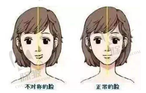 任天平医生肋软骨隆鼻技术原理