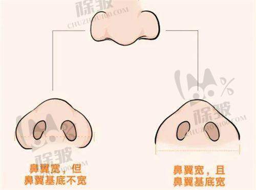 深圳不同医院丰唇项目价格