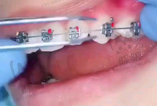 西安小白兔口腔——老牌连锁的儿牙特色服务