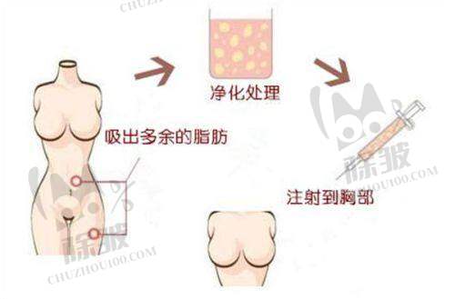 深圳鹏爱嘉祺诊所光子嫩肤项目价格