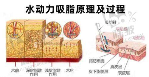 王大勇医生鼻整形修复经验分享