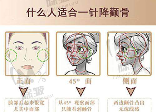 杭州浮想国医疗优质服务巩固口碑