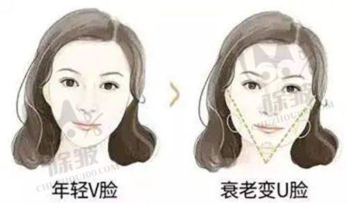 冯志丹医生面部脂肪填充技术亮点