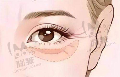 深圳鹏爱嘉祺诊所鼻部整形项目价格