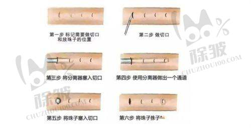 深圳不同地区打下巴项目价格