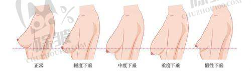 深圳不同医生丰唇项目价格