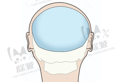 杭州艺星整形价格影响因素