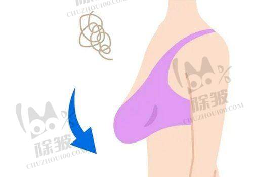 杭州艺星整形选择建议