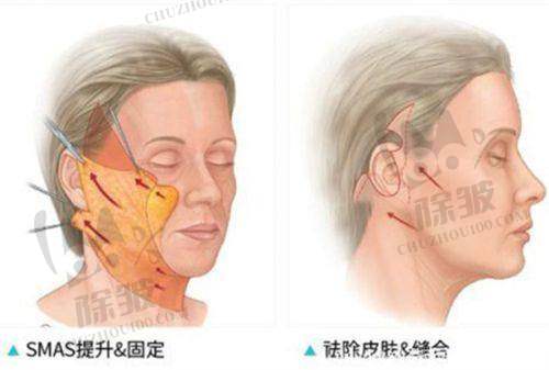 排名第三：华韩与高亚东医生