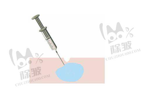 杭州艺星整形医生李俊霞