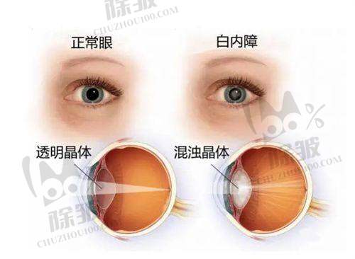 广东省妇幼保健院眼科收费价格表/收费标准
