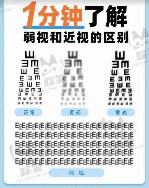 广东省妇幼保健院眼科特色项目及技术优势