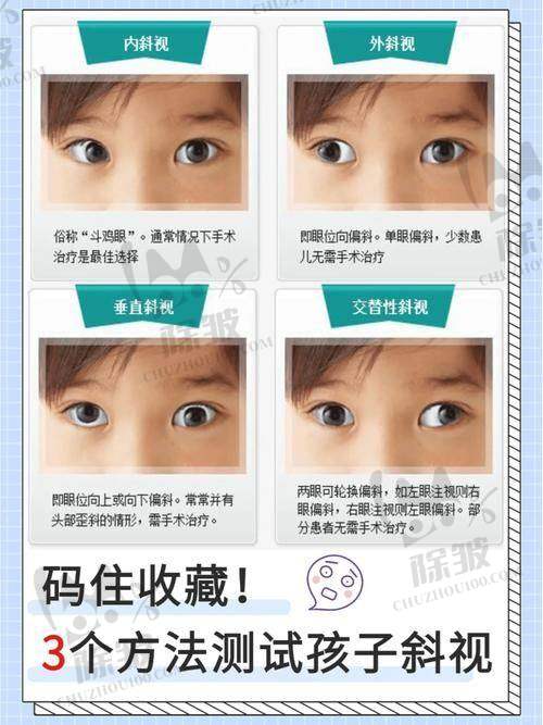 广东省妇幼保健院眼科医生团队实力强大及骨干医生简介