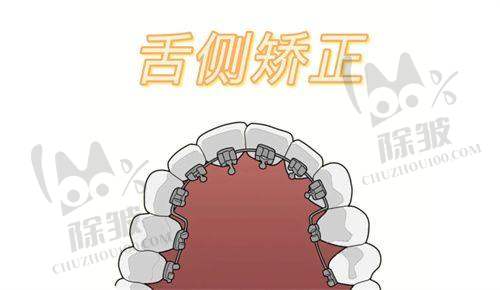 淮北矿工总医院口腔科详细的预约挂号方式及流程