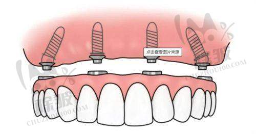 温州医 科 大学附属第一医院口腔科收费价格表/收费标准