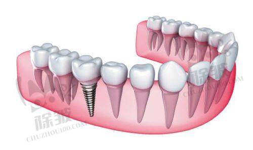淮北矿工总医院口腔科医生团队实力强大及骨干医生简介