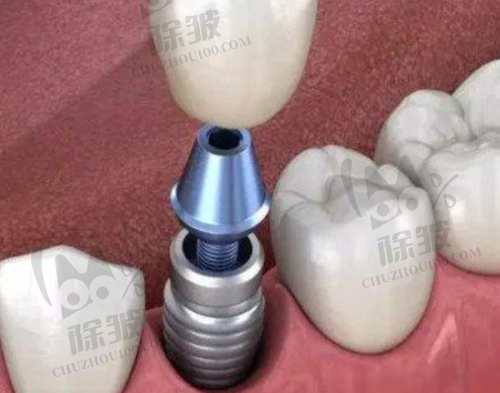 淮北矿工总医院口腔科收费价格表/收费标准