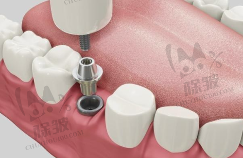 温州医 科 大学附属第一医院口腔科真人口碑评价怎么样?