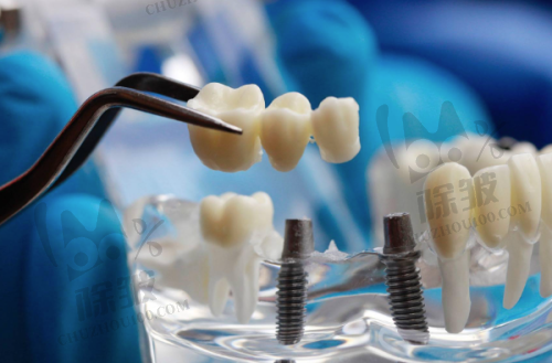 温州医 科 大学附属第一医院口腔科特色项目及技术优势