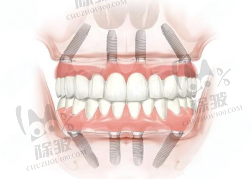 江苏大学附属医院口腔科真人口碑评价怎么样?