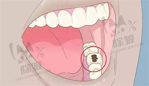 淮北矿工总医院口腔科特色项目及技术优势