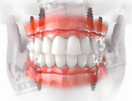 淮北矿工总医院口腔科是正规医院吗?