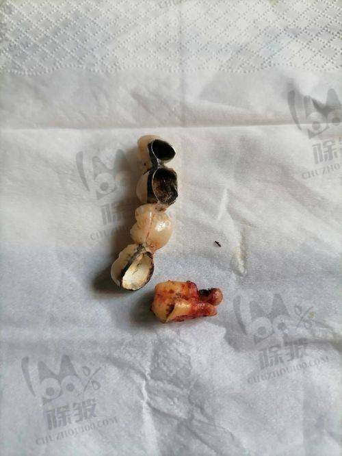 江苏大学附属医院口腔科收费价格表/收费标准