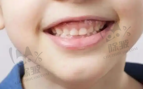 西安中诺口腔医院立得用种植技术获赞
