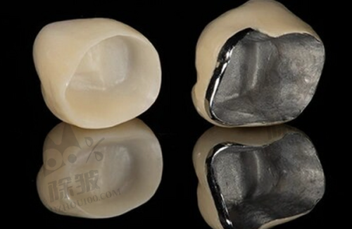 南昌虹桥口腔种植牙成效感受