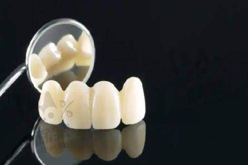 牙齿矫正的选择