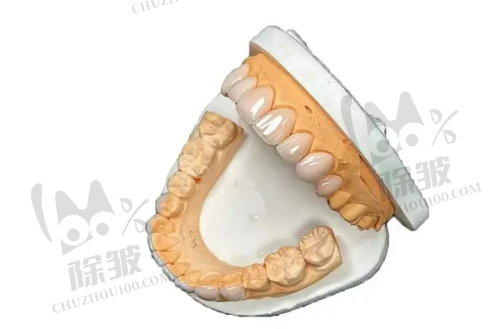 西安牙齿美白成效感受