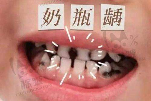 影响西安牙科根管治疗费用的因素总结