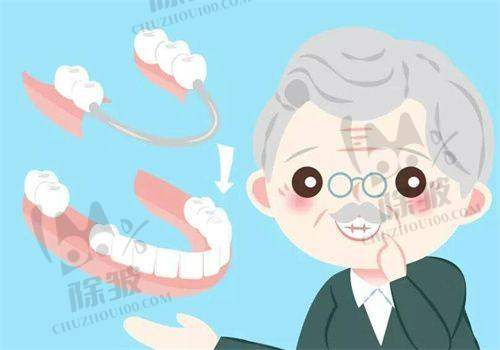 种植牙科普知识