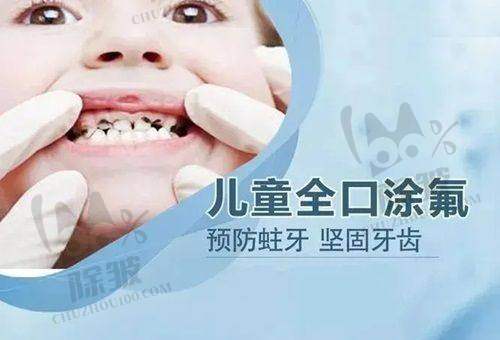 西安牙科根管治疗科普类信息