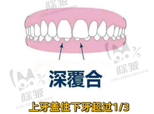 新疆伊犁福宏林口腔种植牙相关项目价格