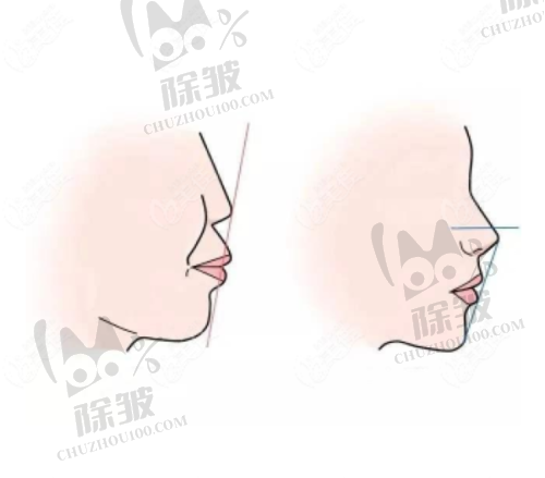 南京茀莱堡口腔民营可靠吗：患者反馈评价好