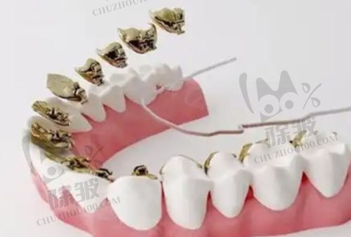 南昌虹桥口腔医院种植牙成效感受