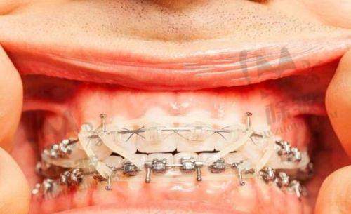 上海松丰口腔百仕门诊部真人口碑评价怎么样?