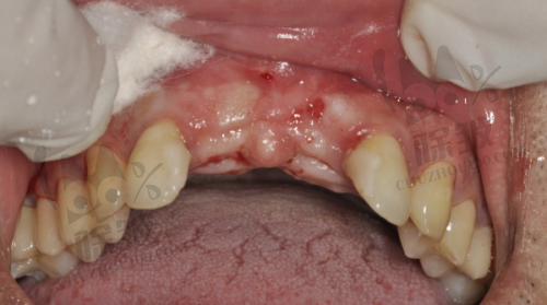 上海松丰口腔百仕门诊部收费价格表/收费标准