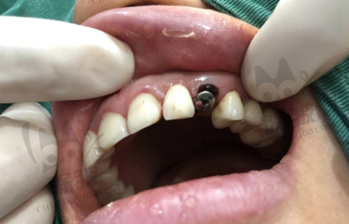 上海松丰口腔悦康门诊部(爱琴海店)详细的预约挂号方式及流程