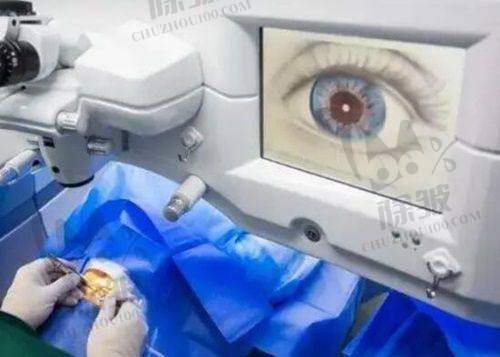 西安四院眼科就诊注意事项