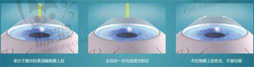患者对普瑞眼科医院的口碑评价