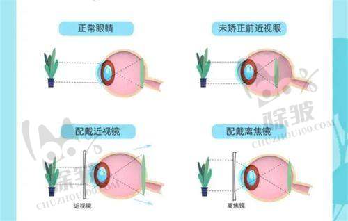 西安四院眼科挂号方式