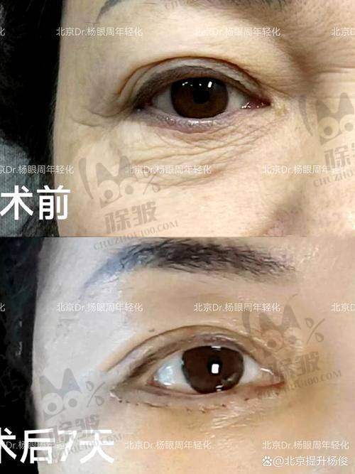 韶关市第一人民医院整形美容科真人口碑评价怎么样?