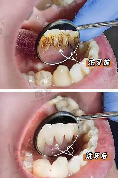 上海中喜元富口腔门诊部是正规医院吗?