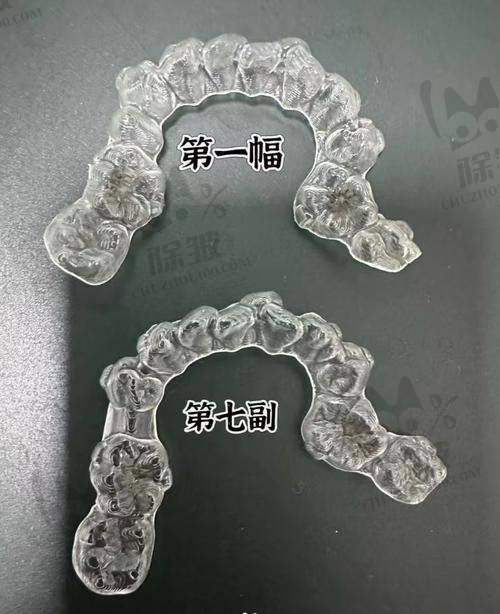 上海新迈口腔门诊部真人口碑评价怎么样?