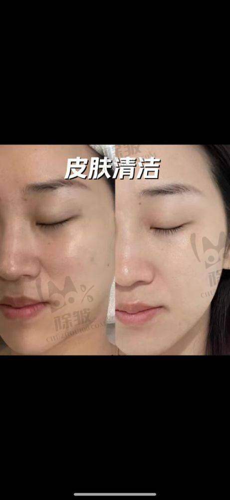 韶关市第一人民医院整形美容科地址电话营业时间