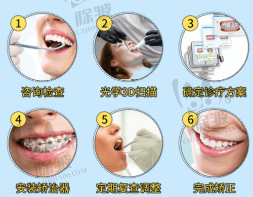 深圳社保二档牙科不可报销的项目