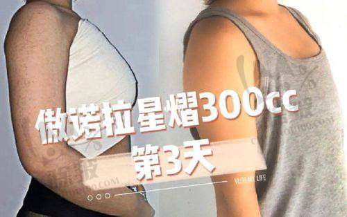 上海优嘉美医疗美容服务怎么样:贴心关怀全程相伴