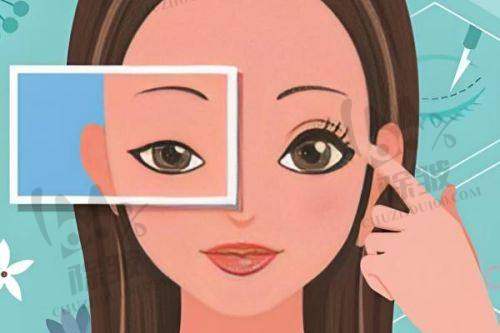 浙二眼科近视手术预约流程及注意事项